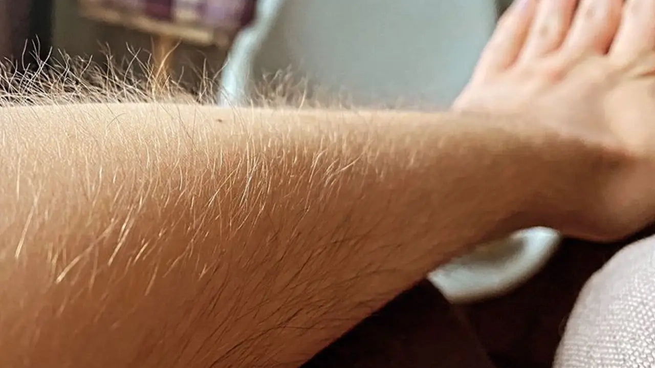 The Relationship Between Hair and Skin